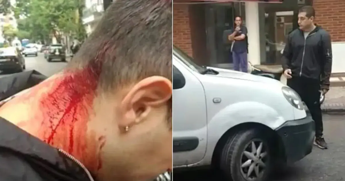 Discutió con un taxista, le pegó con un fierro en la cabeza y lo arrastró en el capó 641e3c4302139.webp