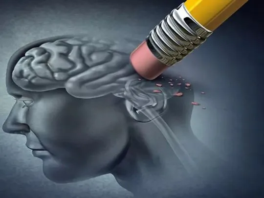 Proteger al cerebro del Alzheimer