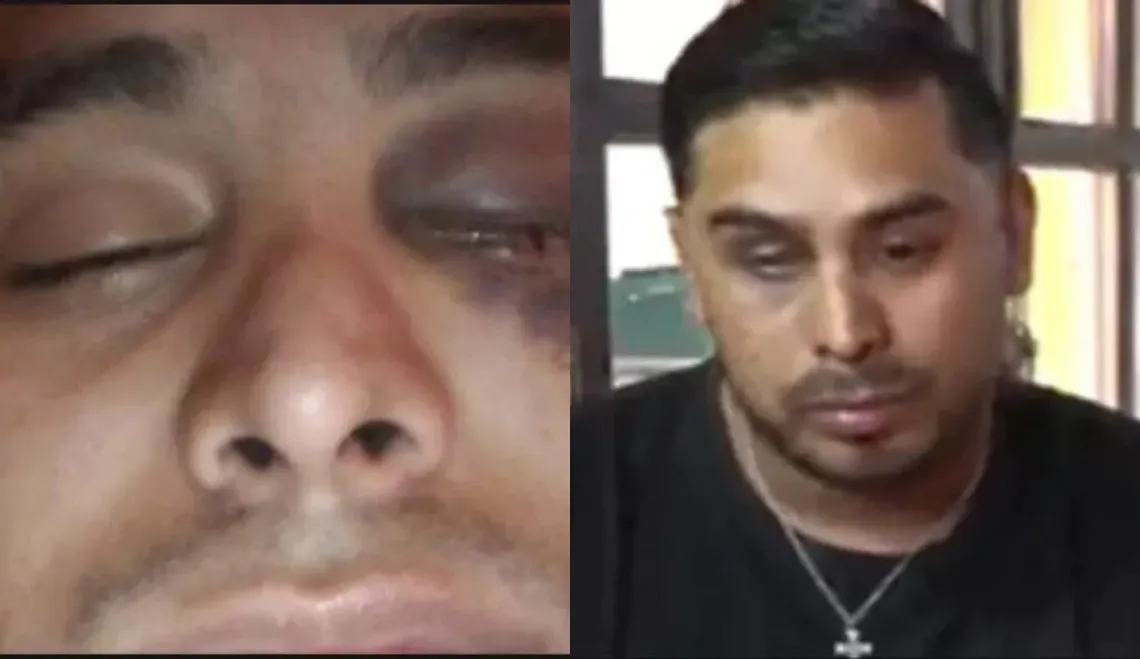 Se atrasó en el pago del alquiler, el locatario le pegó un culatazo y perdió un ojo