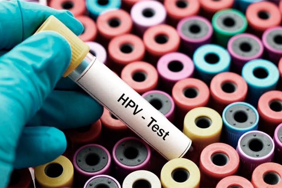 Cáncer De Cuello De útero