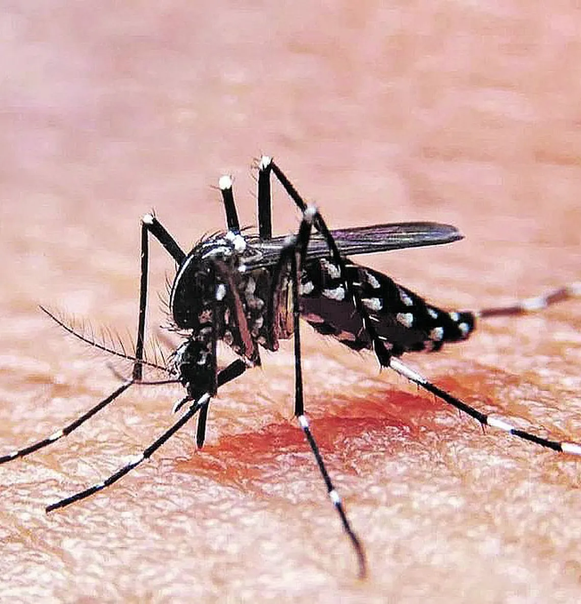 Dengue