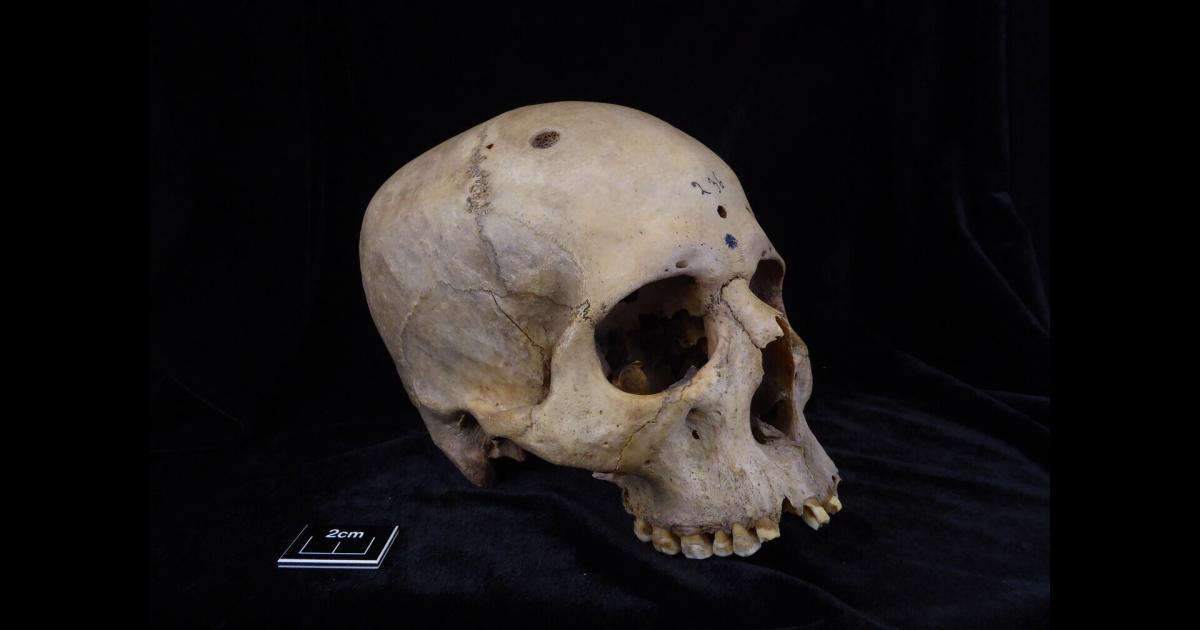 Los Antiguos Egipcios Ya Intentaron Tratar El Cáncer 66573a48597bb.jpeg